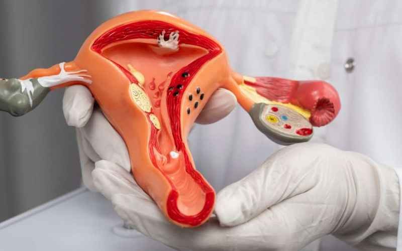 Can Uterine Fibroids Harm Pregnancy? Know Common Symptoms and Treatment