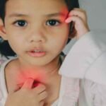 Childhood Eczema: Understanding, Coping, and Managing