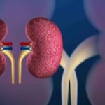 Detecting Kidney Cancer: Signs to Watch Out For and Treatment Options