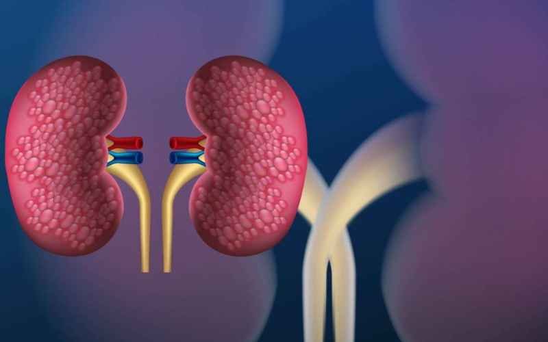 Detecting Kidney Cancer: Signs to Watch Out For and Treatment Options