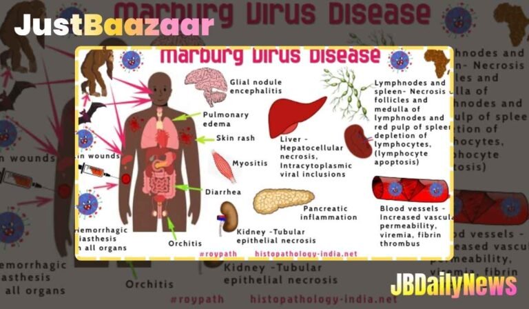 Marburg Virus Disease: Symptoms, Transmission, Prevention & Treatment