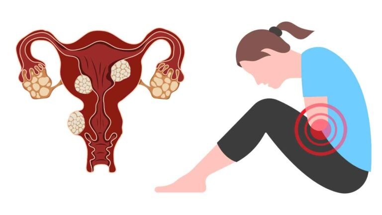 🌸 Ultimate Guide to Fibroids and Fibroids in Uterus: Symptoms, Sizes, and Natural to Medical Treatments 🌸