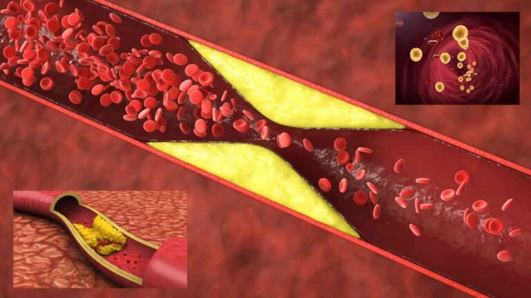What are the Top 5 Cholesterol Medications