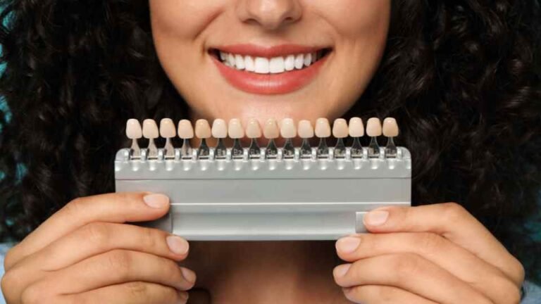 How to Care for Your Veneers: Tips for Longevity and Maintaining a Natural Look