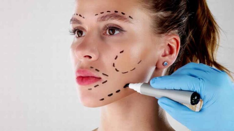 Non-invasive Face Lift